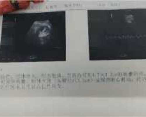 国内预约供卵流程,少精弱精症怀孕几率有多大！一个周期多少！